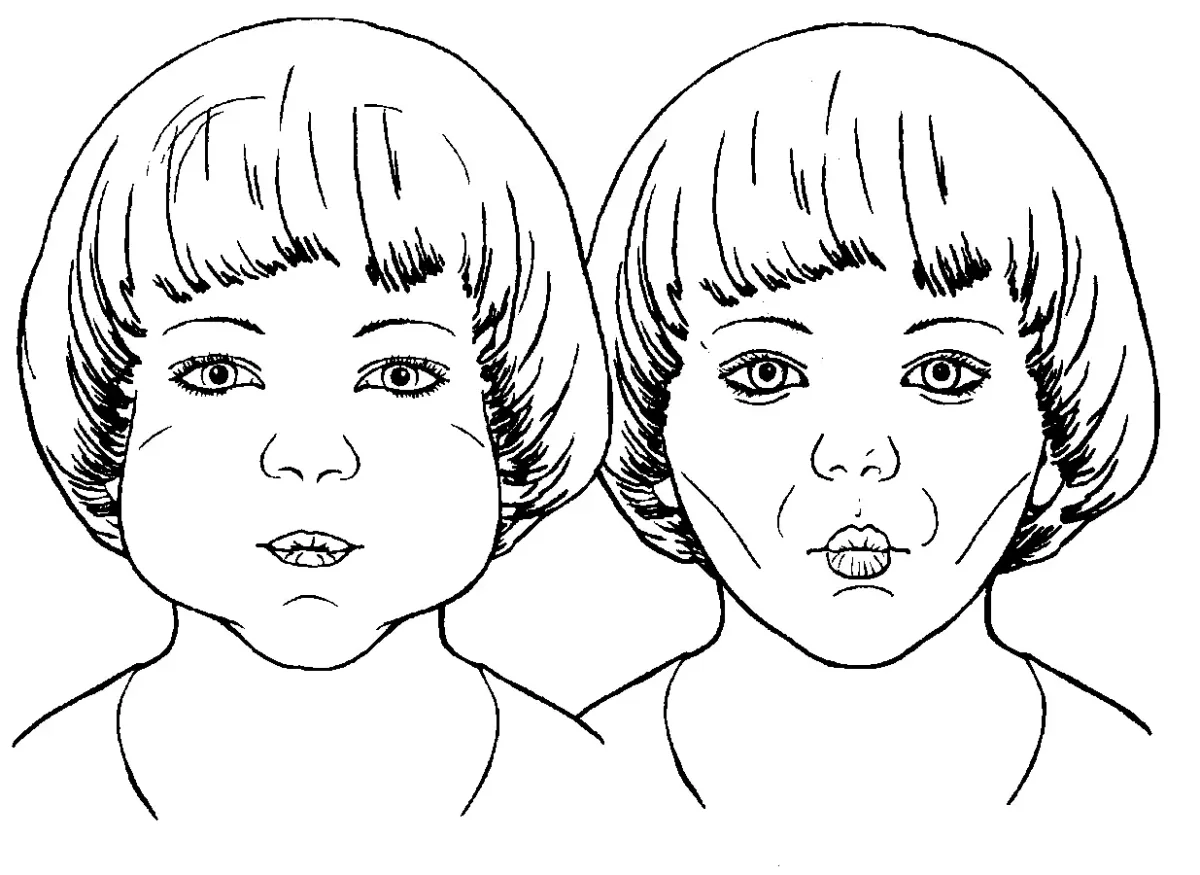 Артикуляционное упражнение толстячки худышки