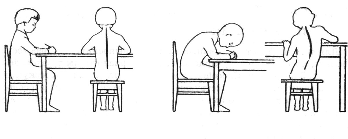 Профилактика искривления осанки