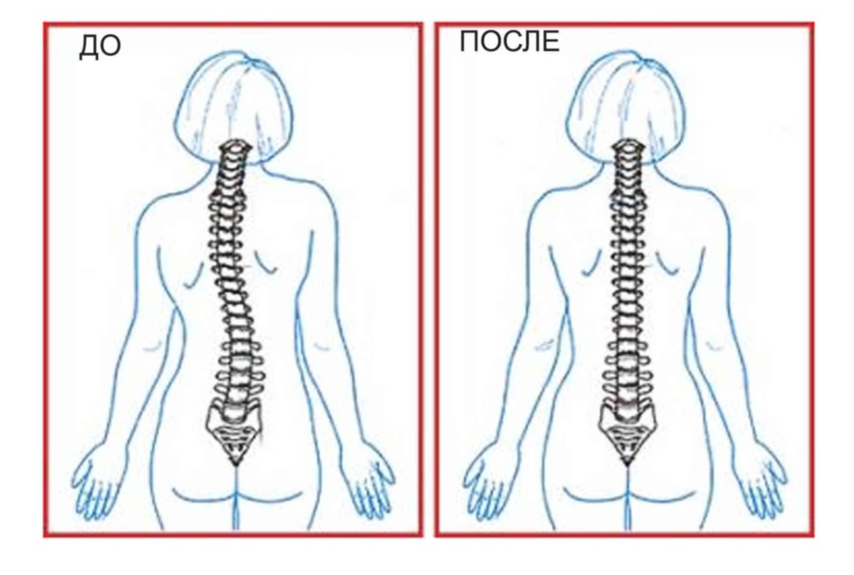 Человек с прямой осанкой