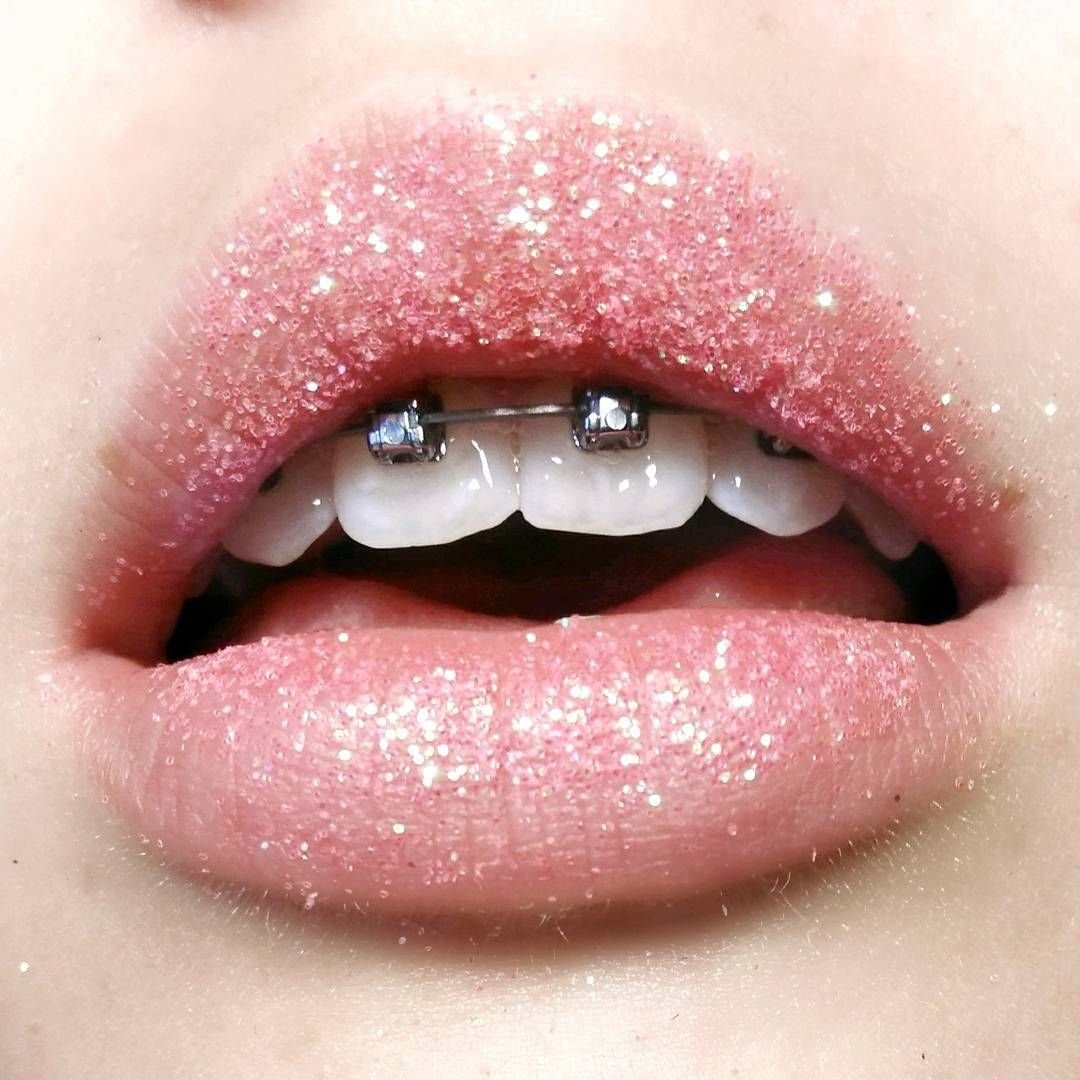 Брекеты красные губы