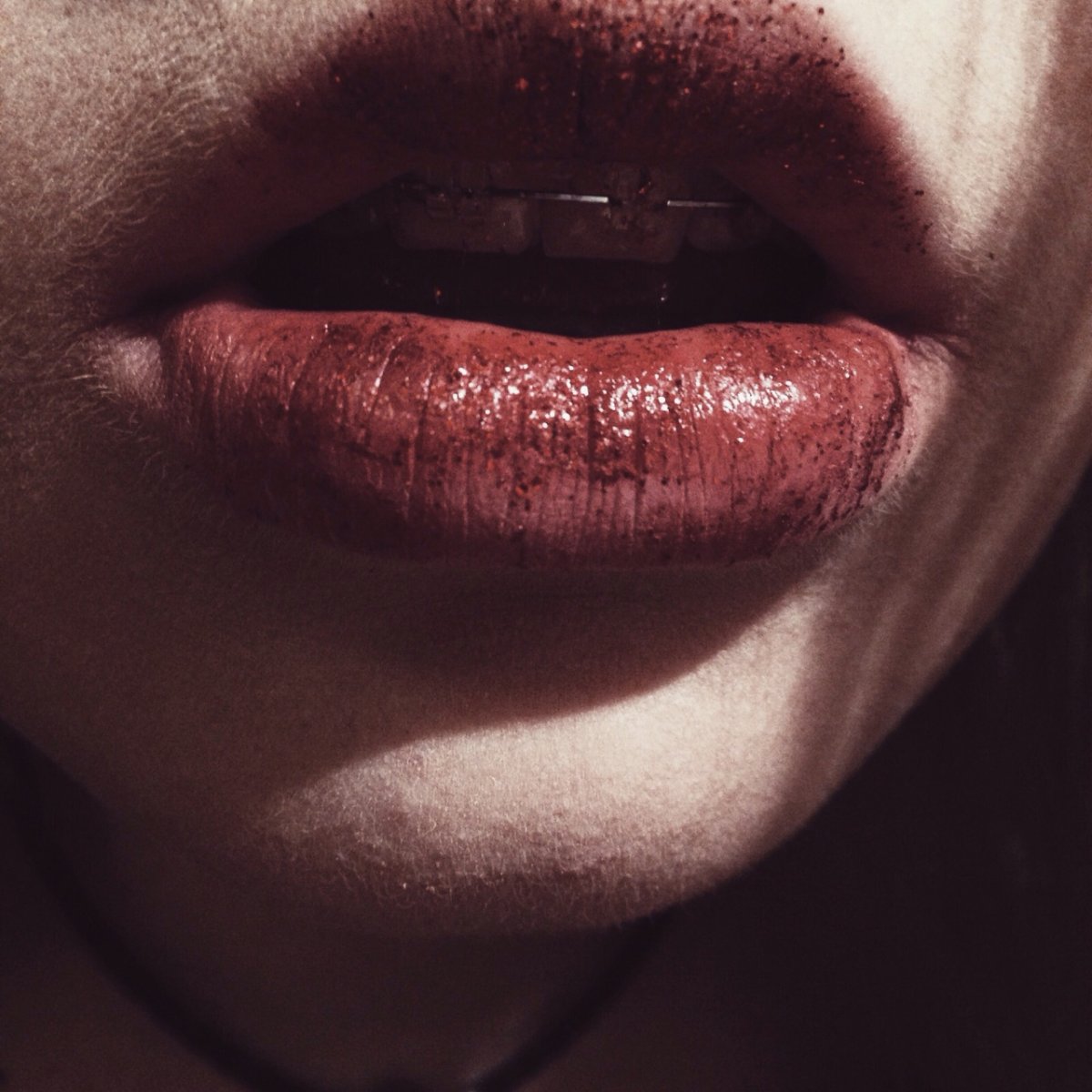 Губы Эстетика